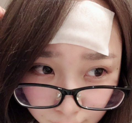 小林退热贴怎么用 小林退热贴使用测评