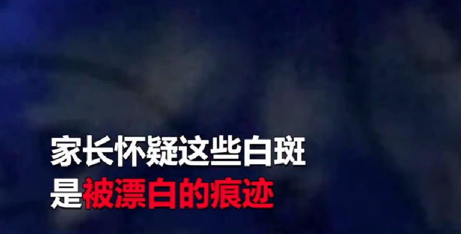 幼儿园用消毒水给孩子泡手怎么回事 为什么幼儿园会用消毒水给孩子泡手