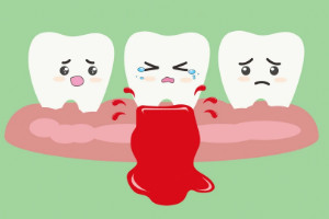 牙龈出血要警惕三种病，牙周炎/血液病/糖尿病(要引起重视)