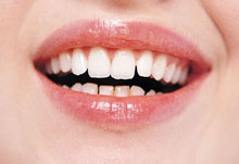 牙龈萎缩的危害有哪些 牙龈萎缩的防治方法介绍