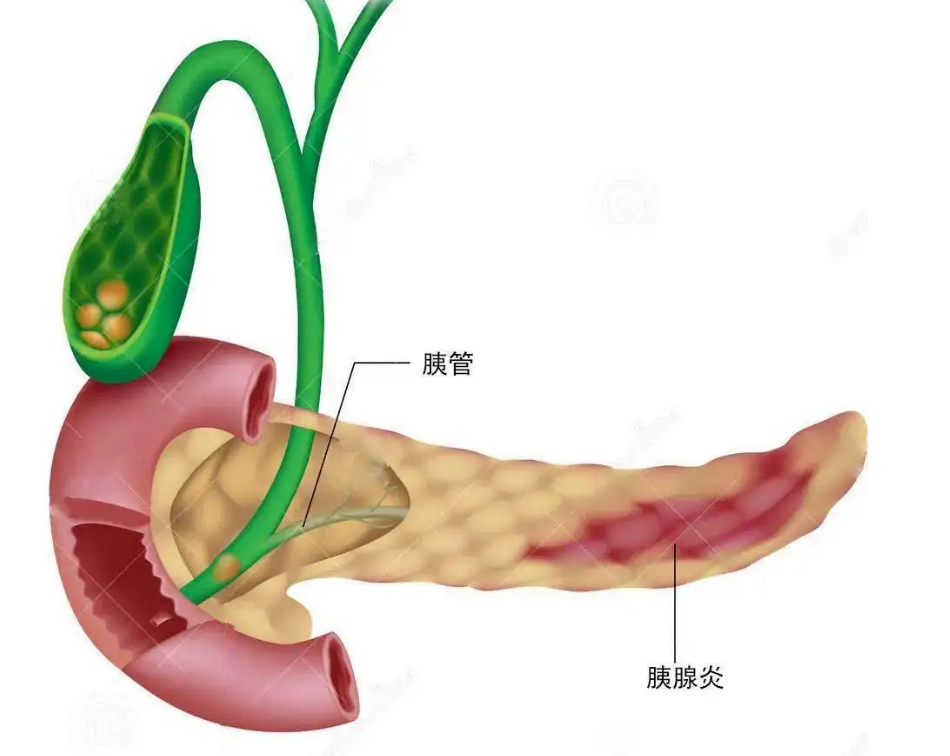 胰腺标准测量图片图片