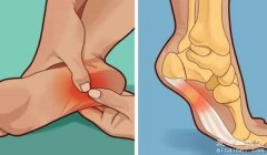 脚底疼痛部位图解，五个部位疼痛的病因（热水泡脚缓解最有效）