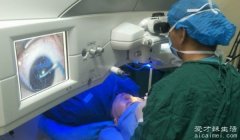 激光近视手术大概多少钱 手术约几千到5万左右（不用方式价格不同）