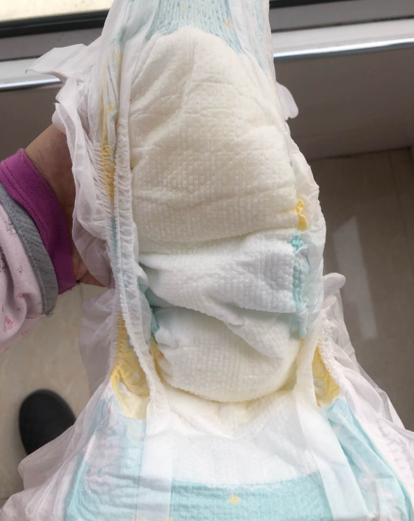 优茵超薄婴儿纸尿裤多久换一次好 优茵超薄婴儿纸尿裤会不会红屁屁