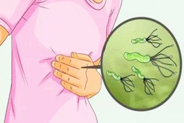 幽门螺旋杆菌是如何感染的 45岁女子感染幽门螺杆菌致胃癌
