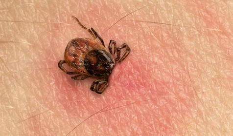 隐翅虫皮炎治疗方法 隐翅虫皮炎可以自愈吗